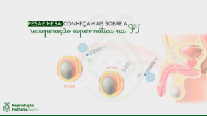 Pesa e Mesa: conheça mais sobre a recuperação espermática na FIV