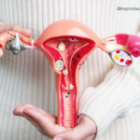 Endometriose pode causar infertilidade? Entenda a relação